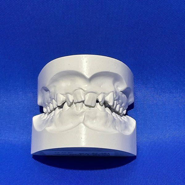 Damrath_Abdruck_Blau