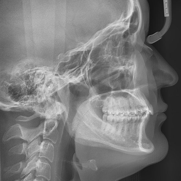 Damrath_Röntgenbild